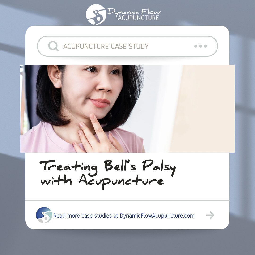A diagnosis can often come with more stress and questions than answers, especially with the sudden onset of something like Bell’s Palsy. Join the list of Dynamic Flow Acupuncture patients who have found relief through acupuncture.